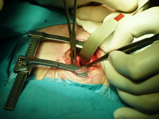 Cirugia torácica neonatal
